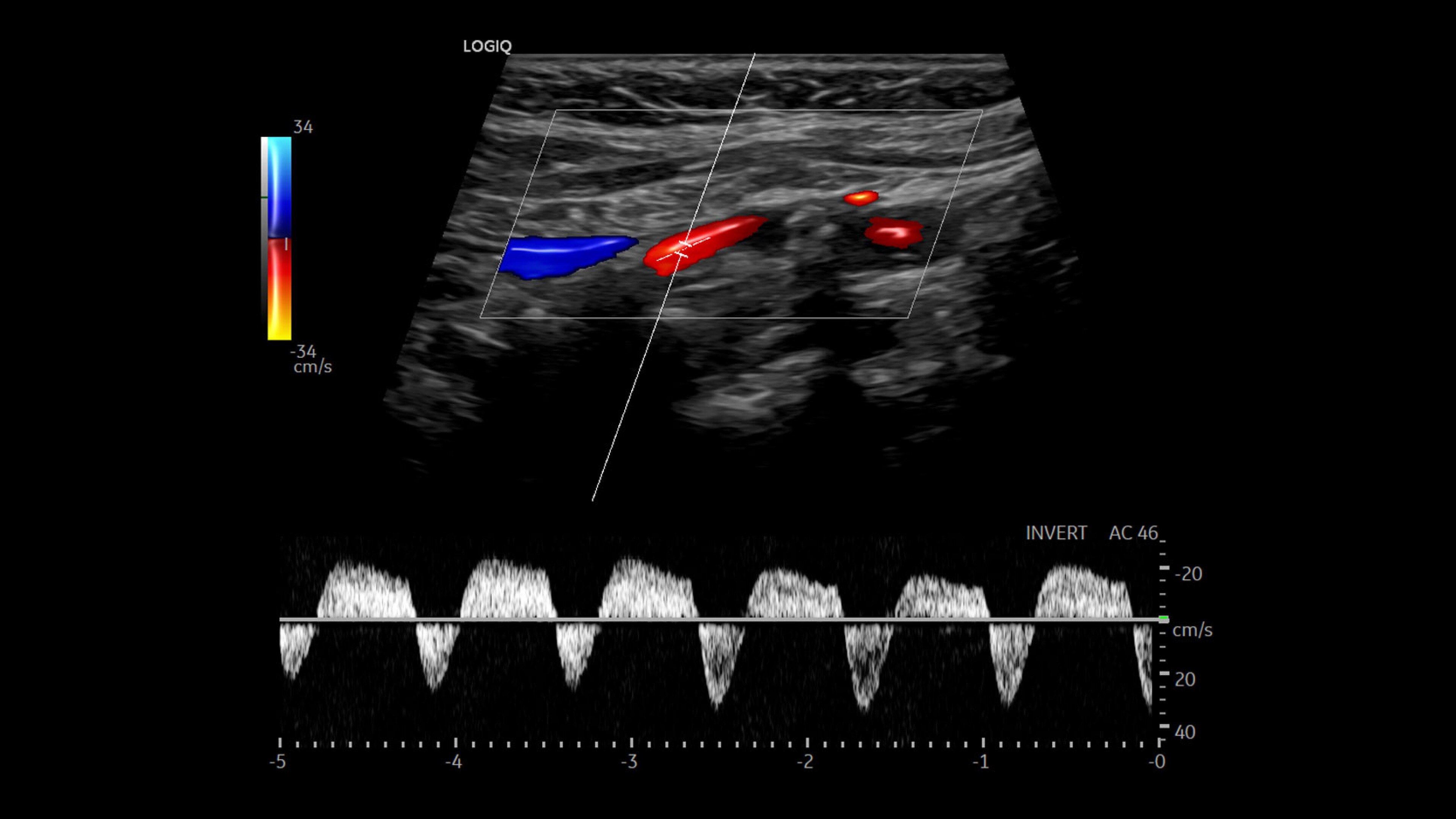 Product Media Carousel Image