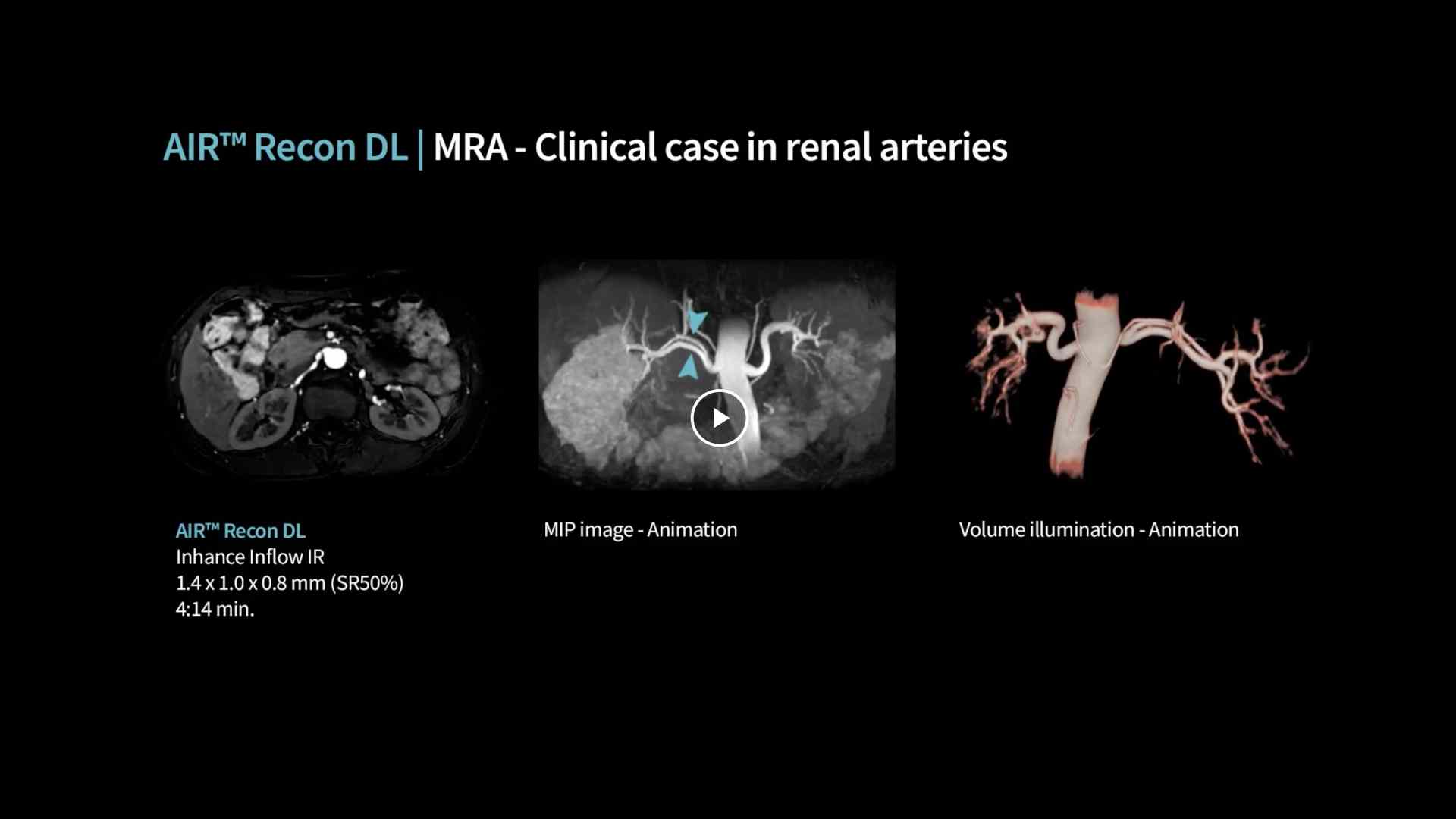 Product Media Carousel Image
