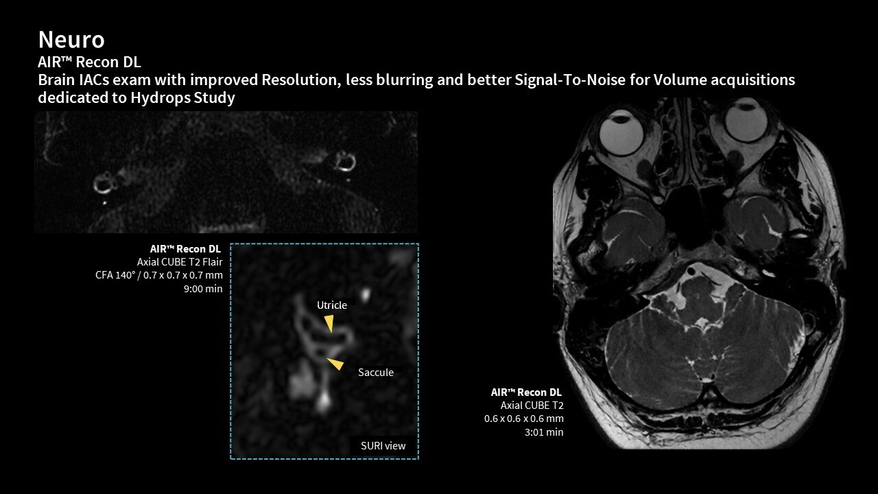 Product Media Carousel Image