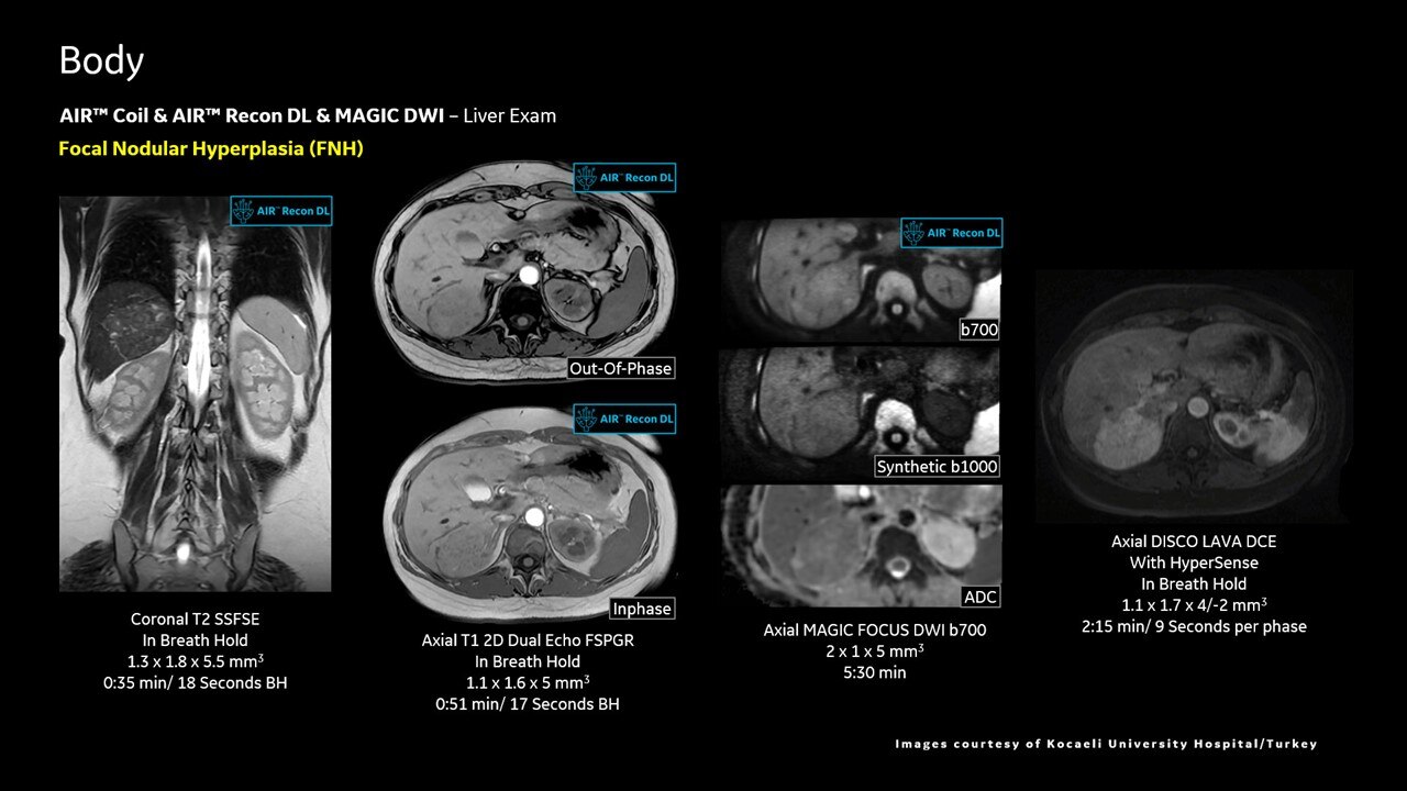 Product Media Carousel Image