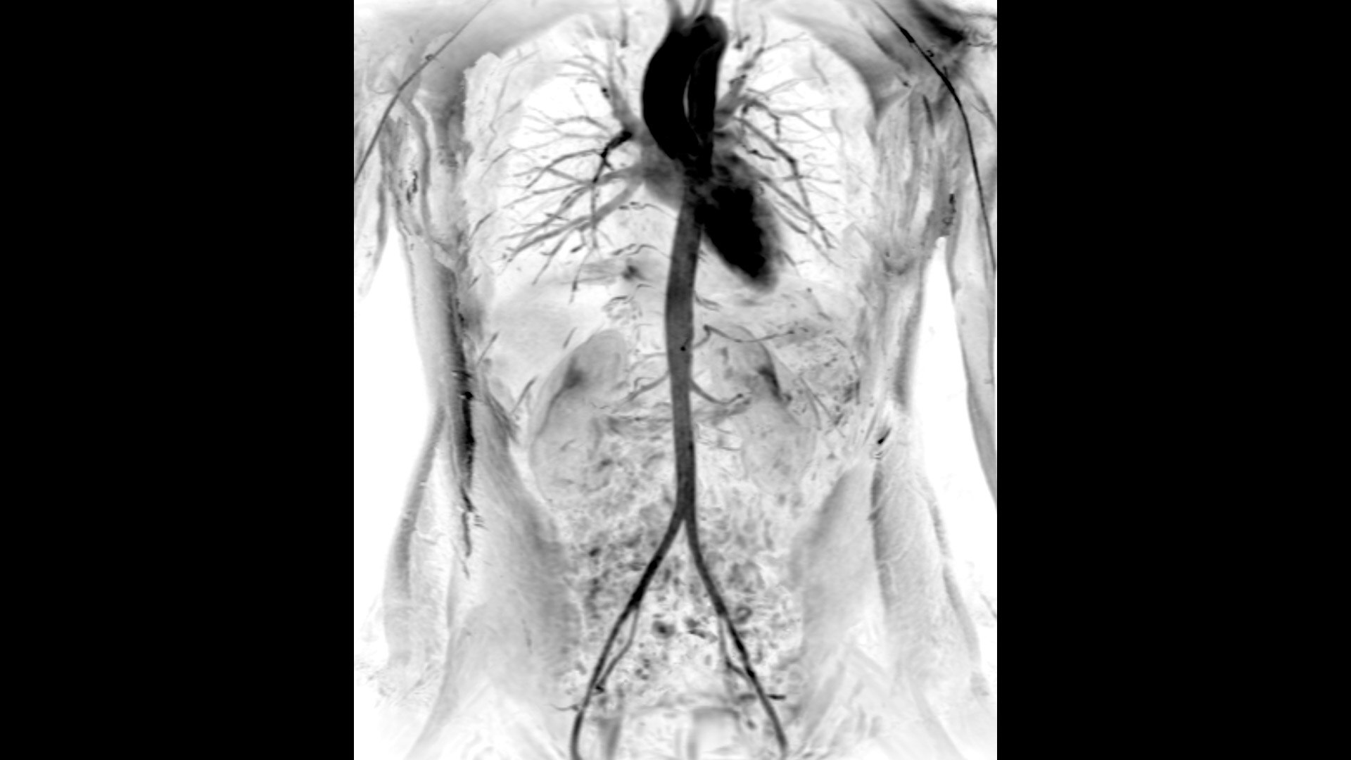 Product Media Carousel Image