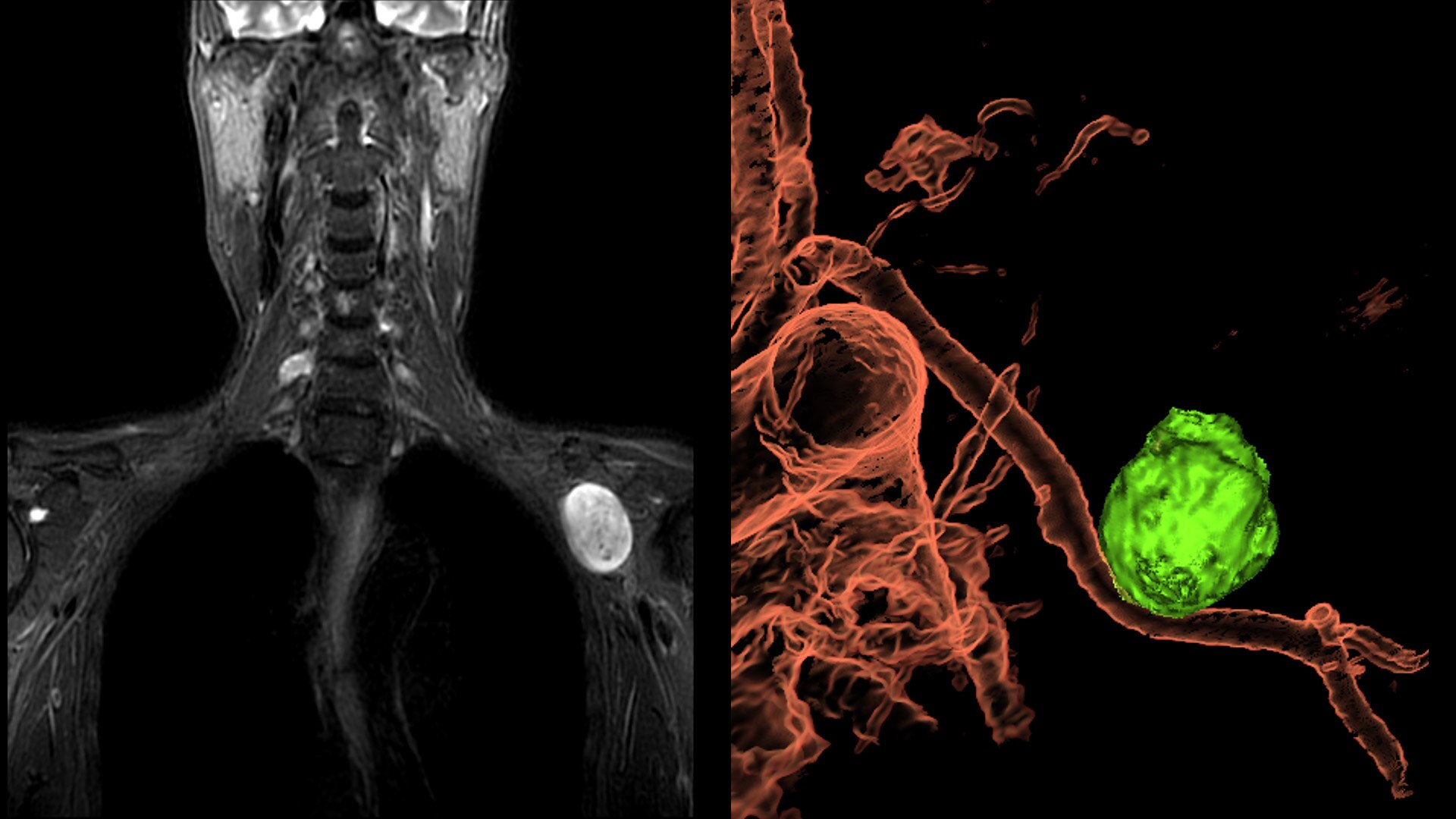 Product Media Carousel Image