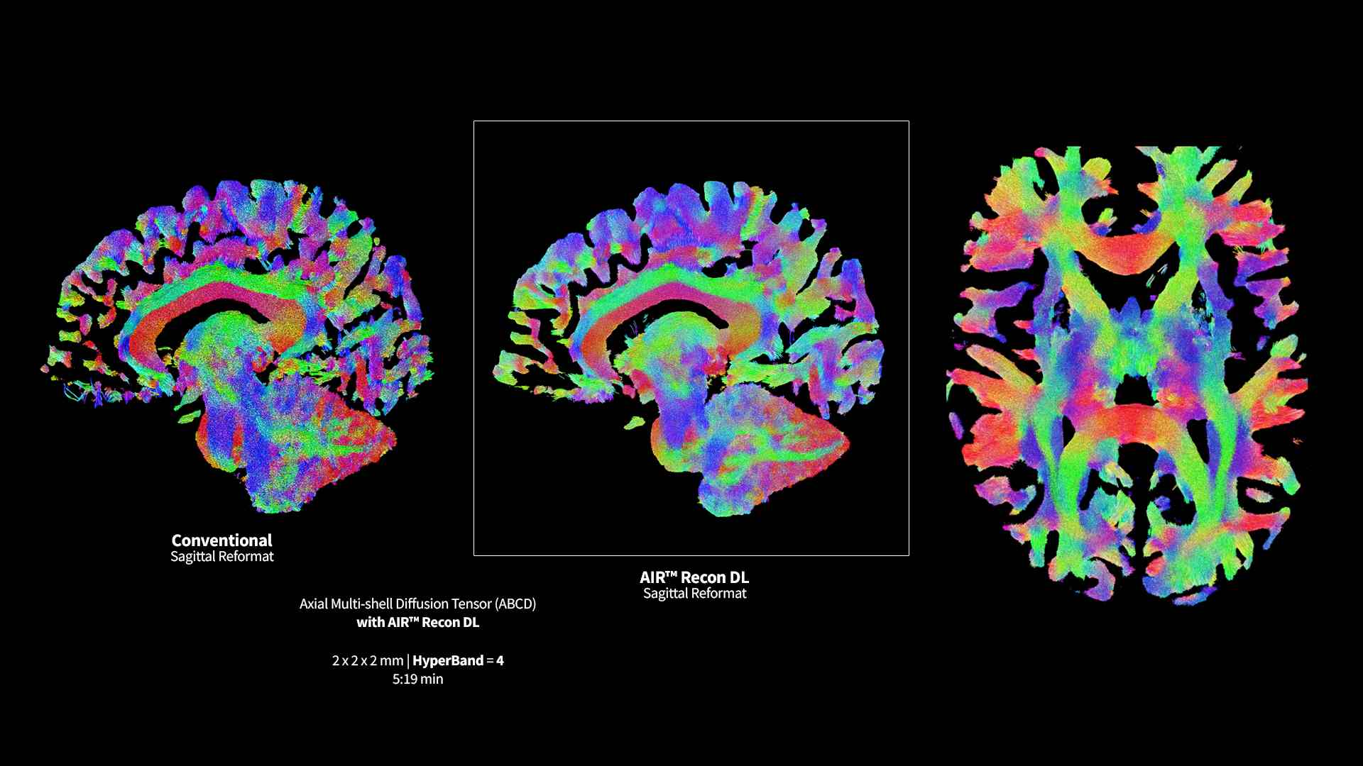 Product Media Carousel Image