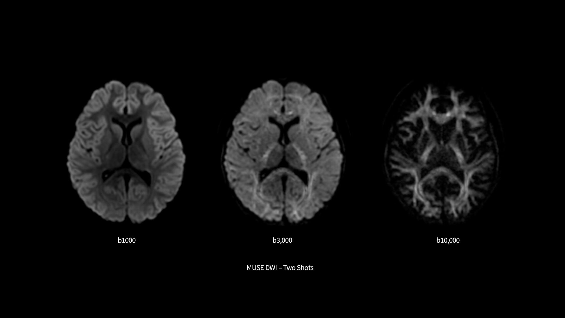 Product Media Carousel Image