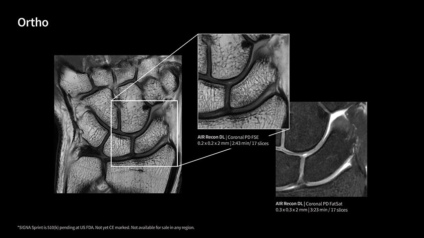 Product Media Carousel Image