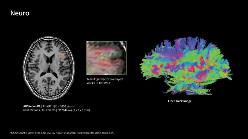 Product Media Carousel Image