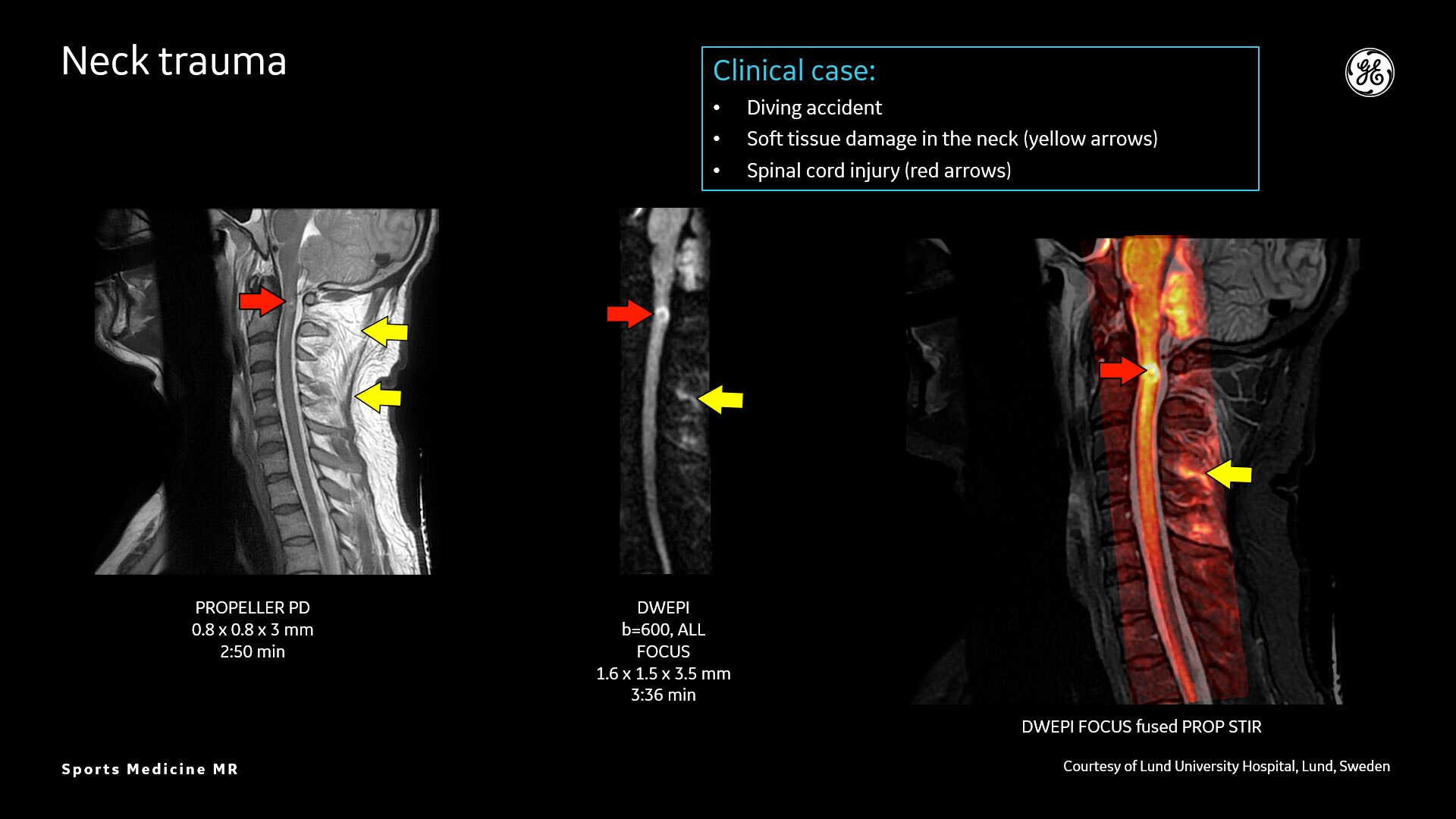 Product Media Carousel Image