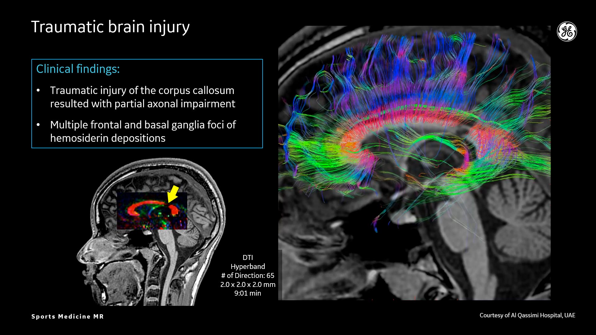 Product Media Carousel Image
