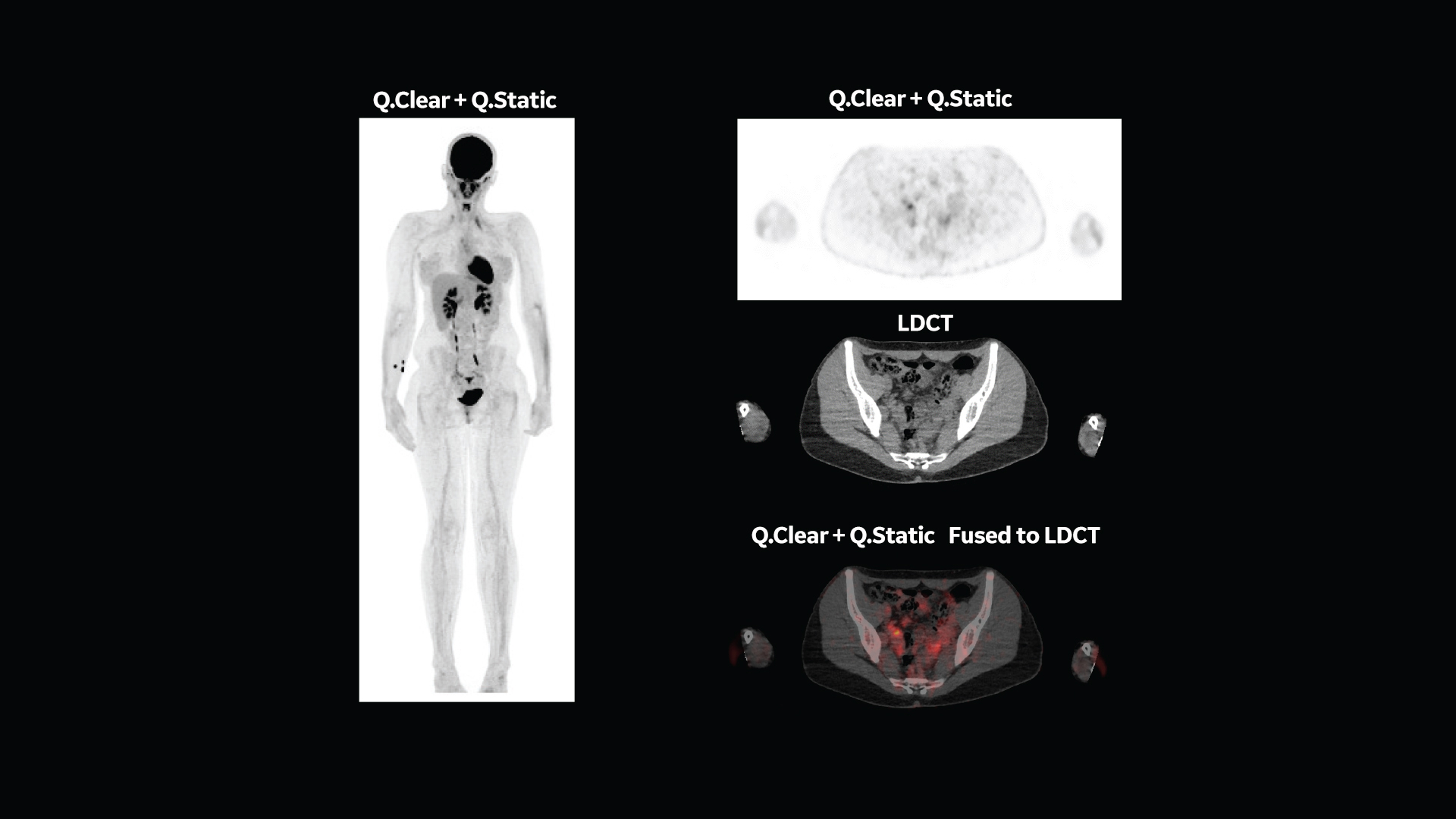Product Media Carousel Image