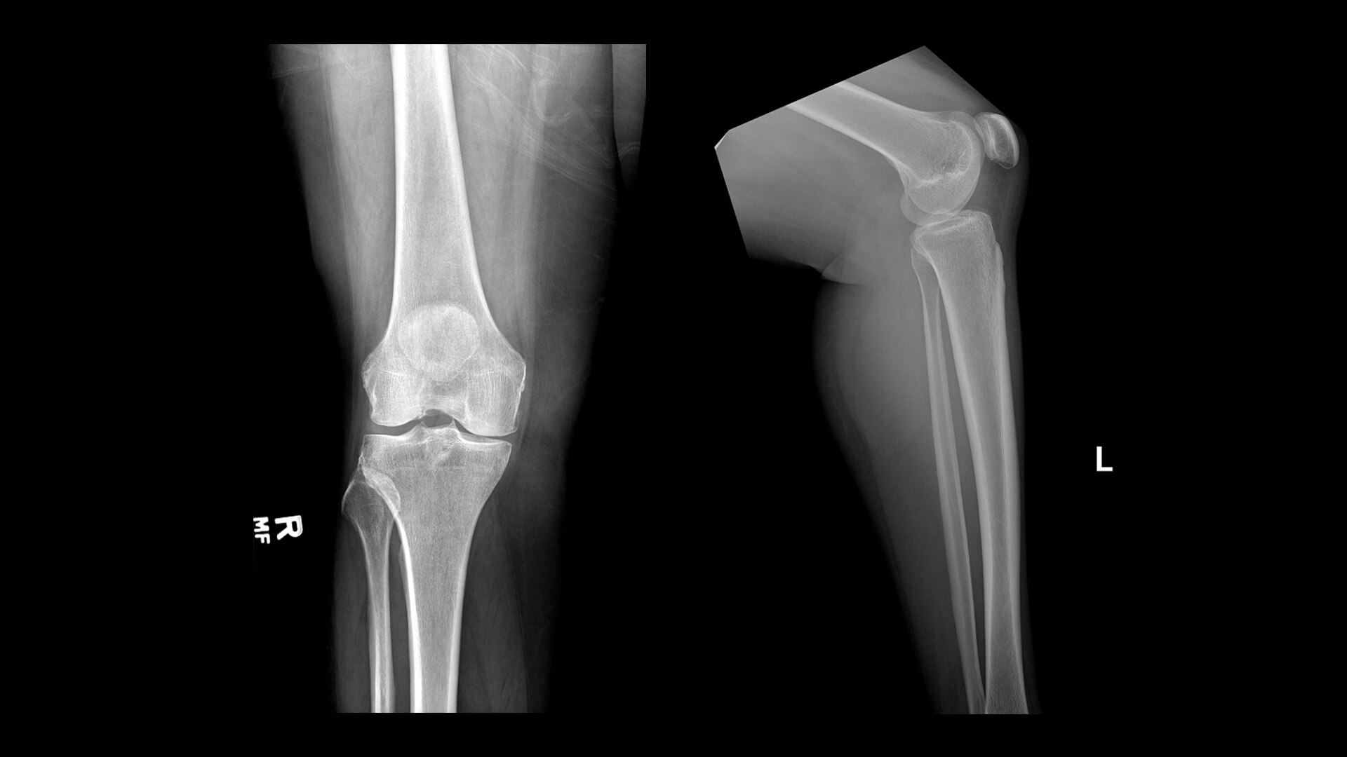 Product Media Carousel Image