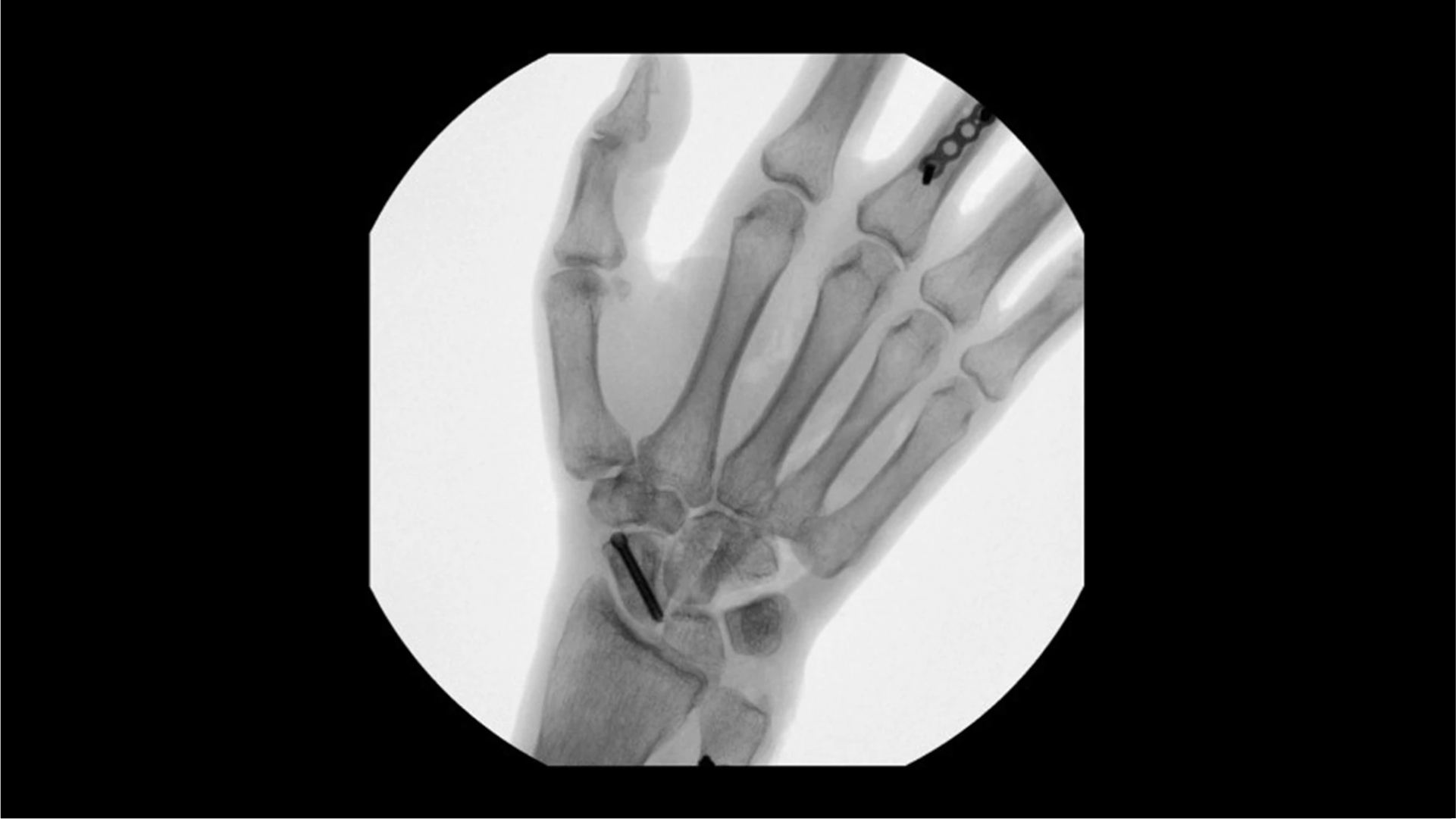 Product Media Carousel Image