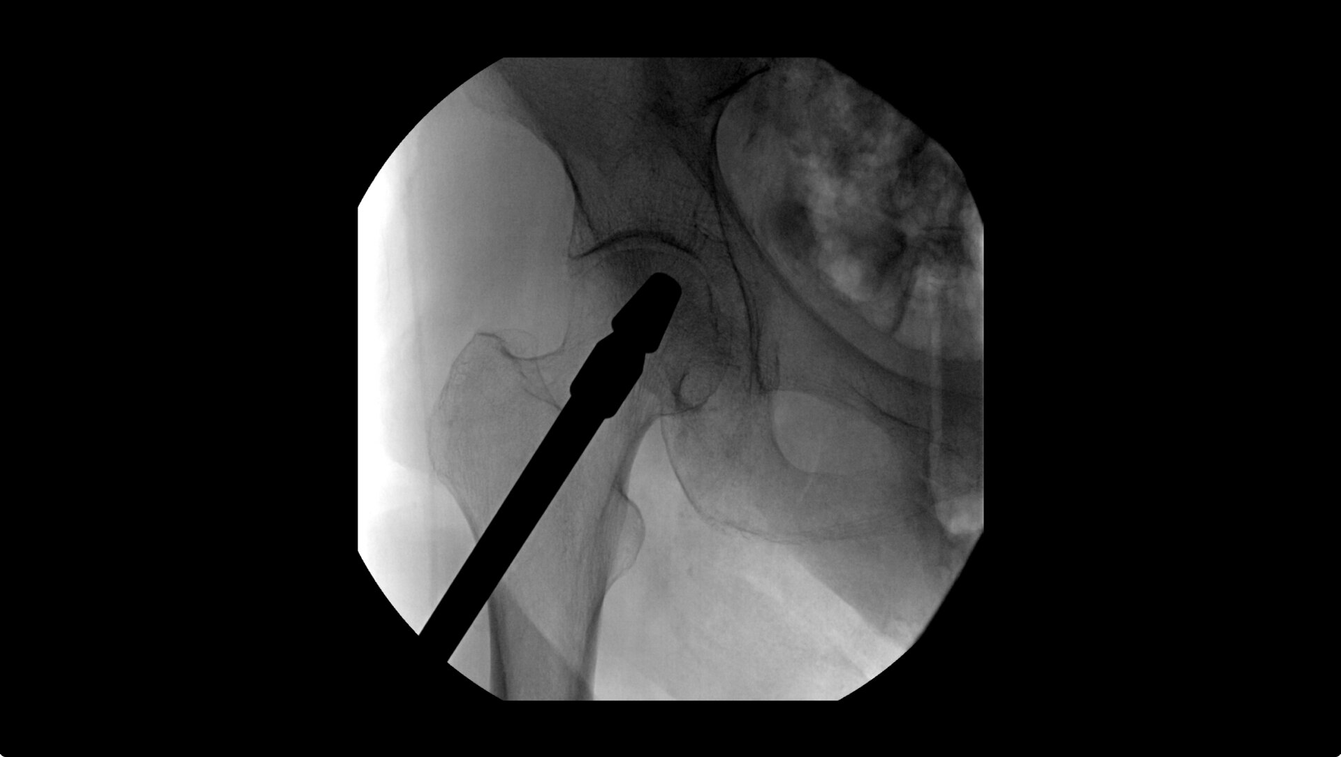 Product Media Carousel Image