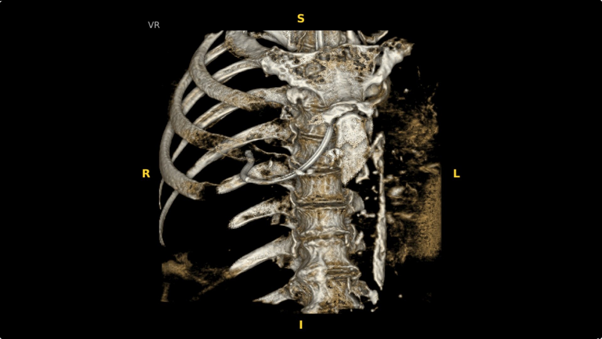 Product Media Carousel Image