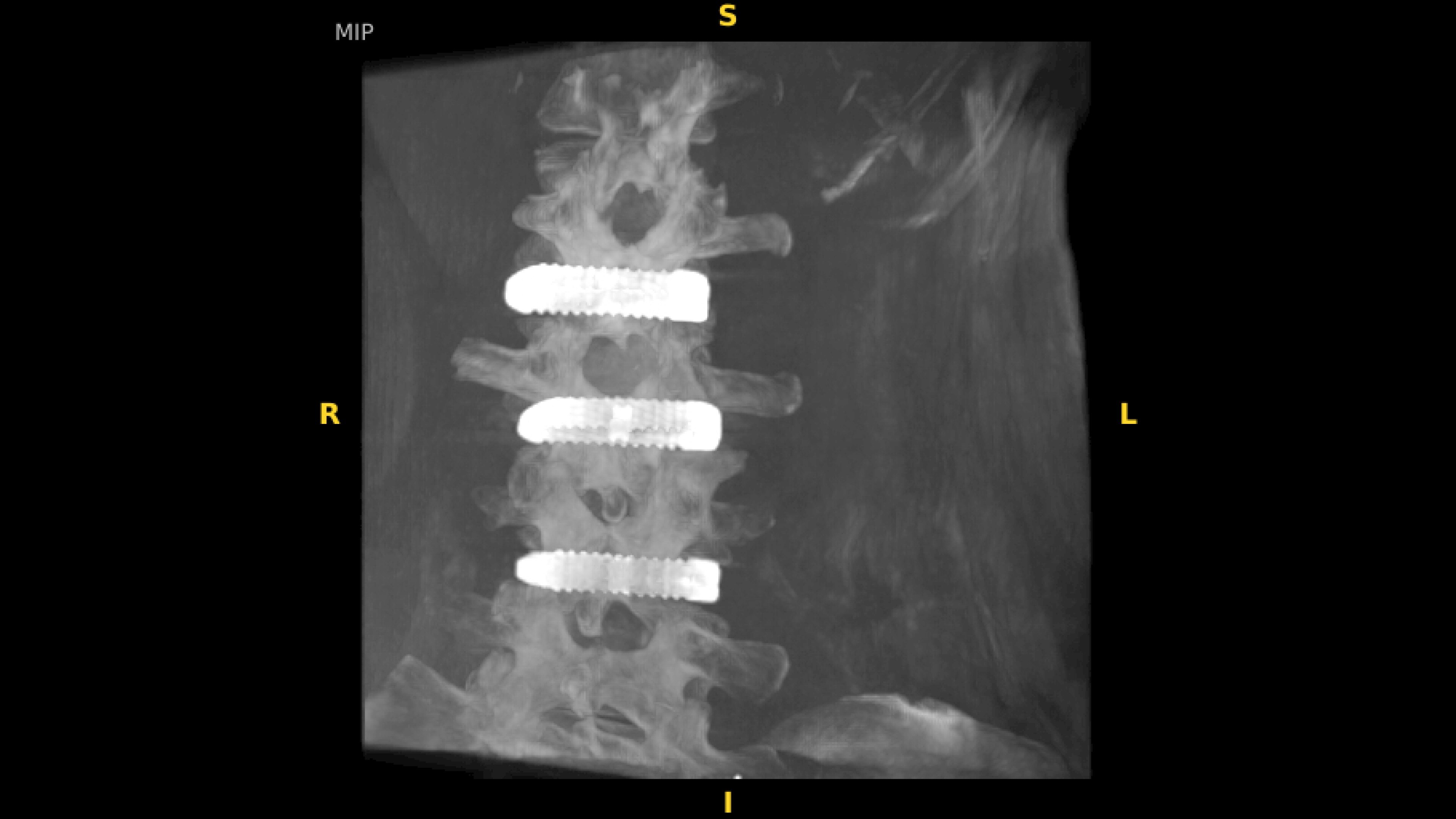 Product Media Carousel Image