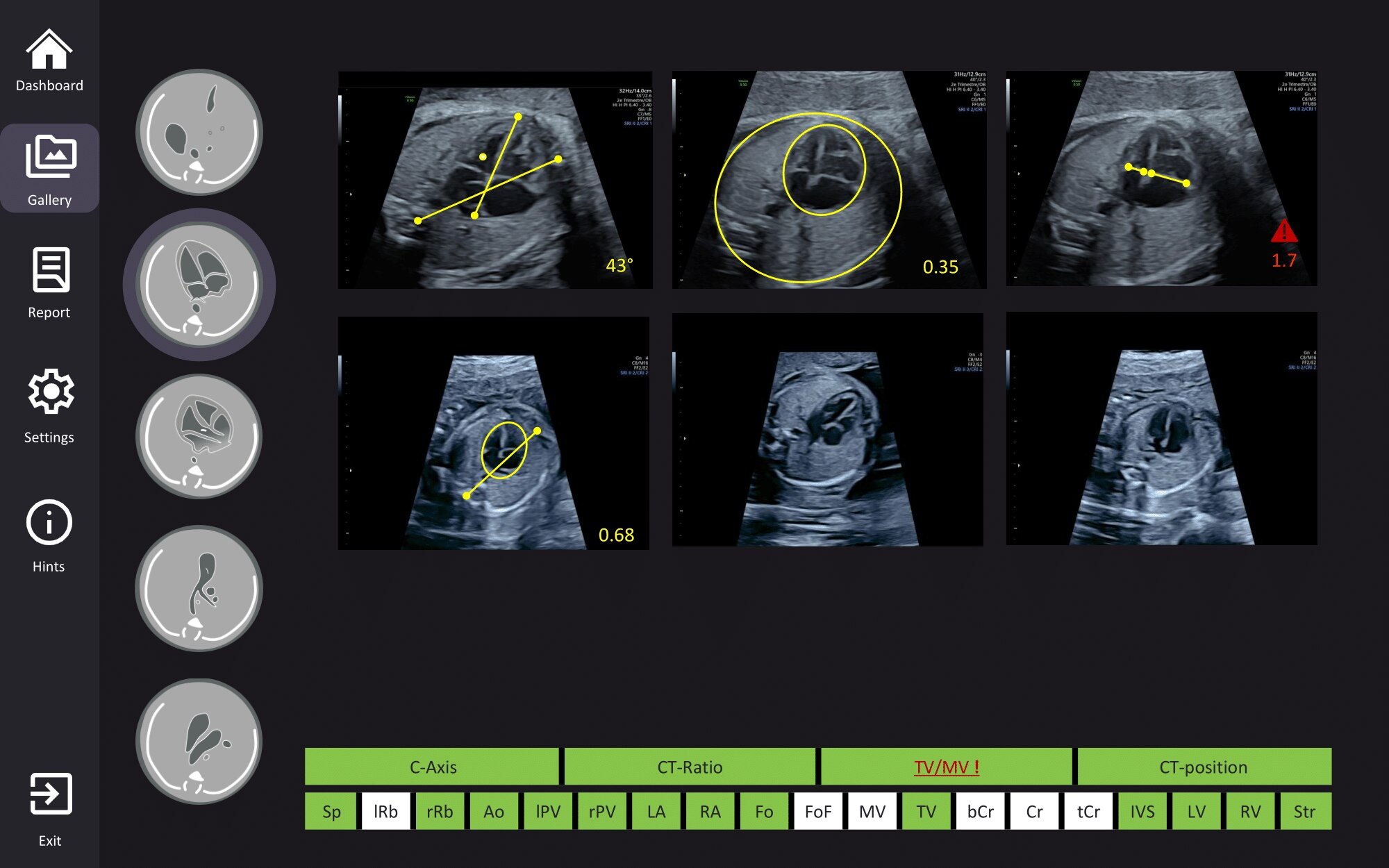 Product Media Carousel Image