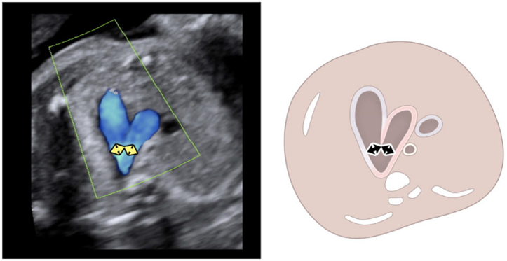 Product Media Carousel Image