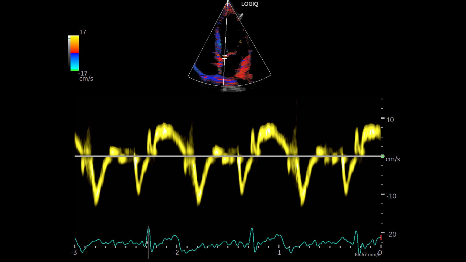 Product Media Carousel Image
