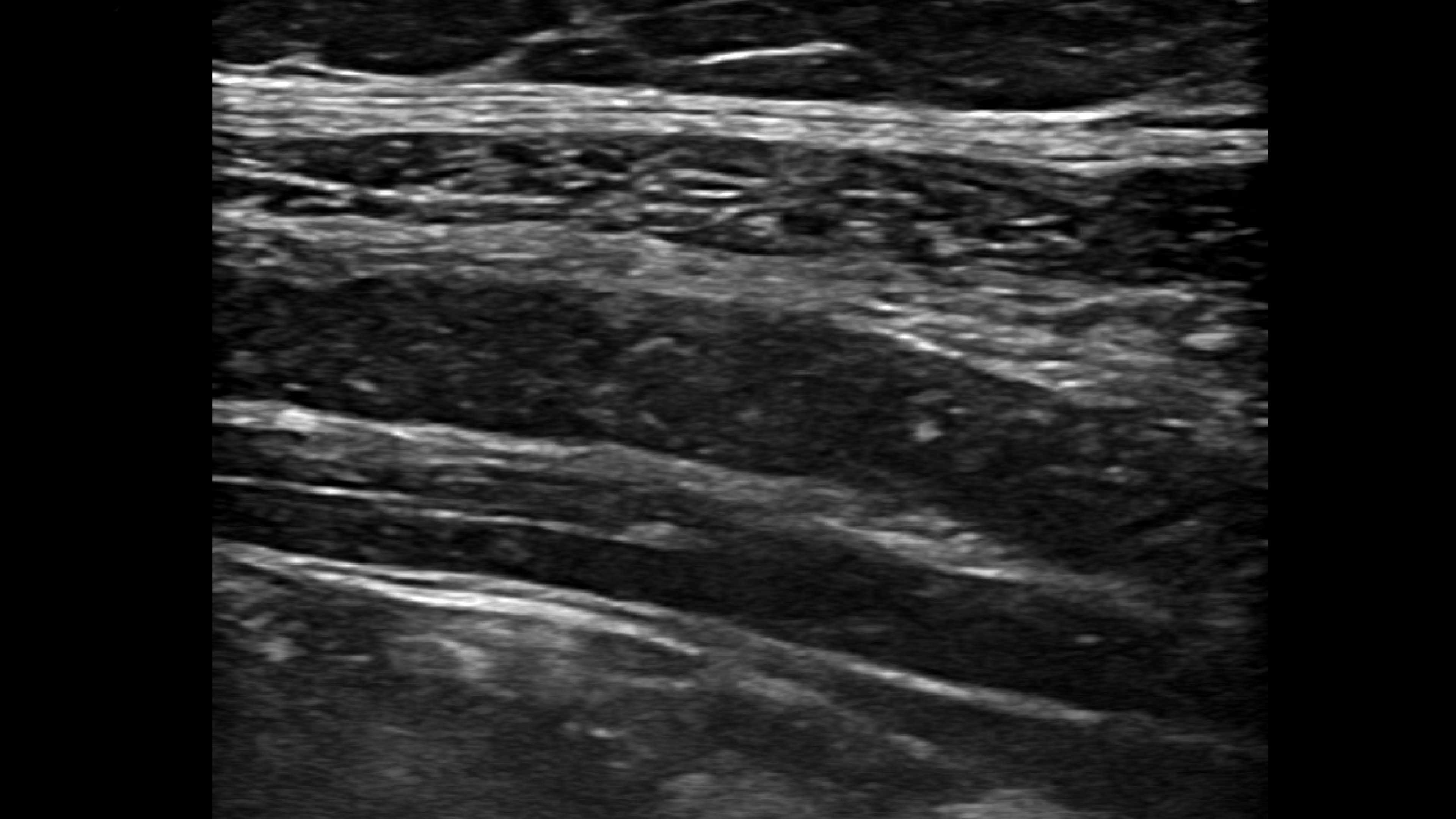 Product Media Carousel Image