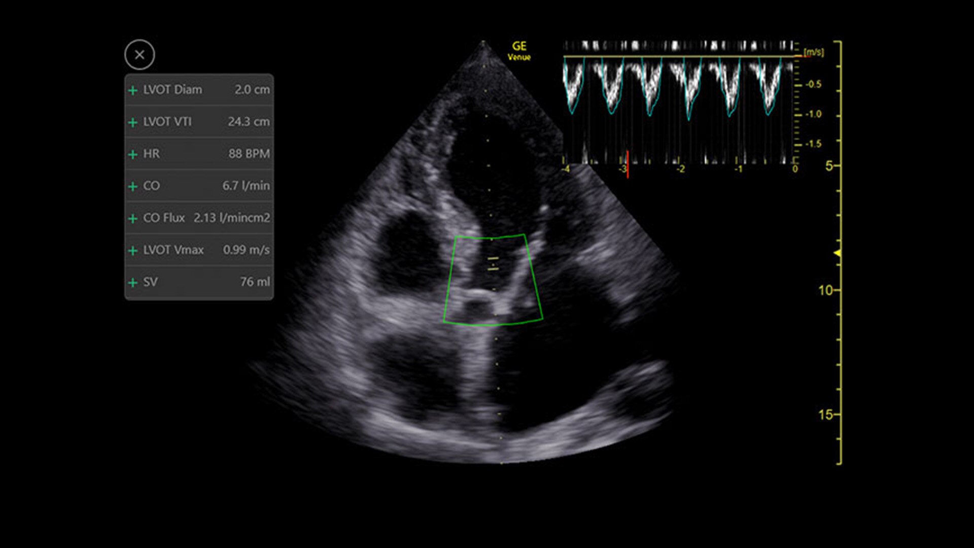 Product Media Carousel Image