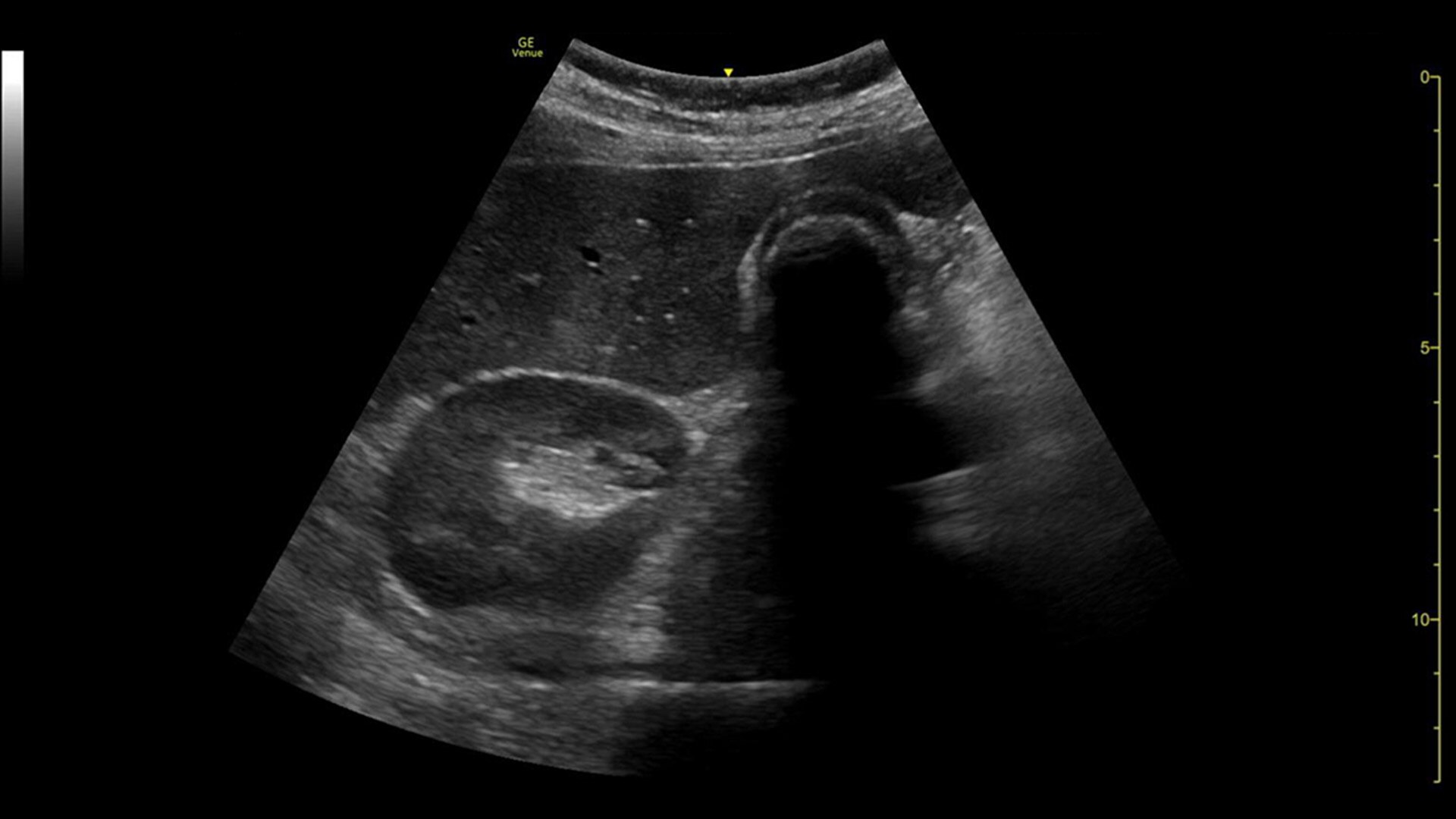 Product Media Carousel Image