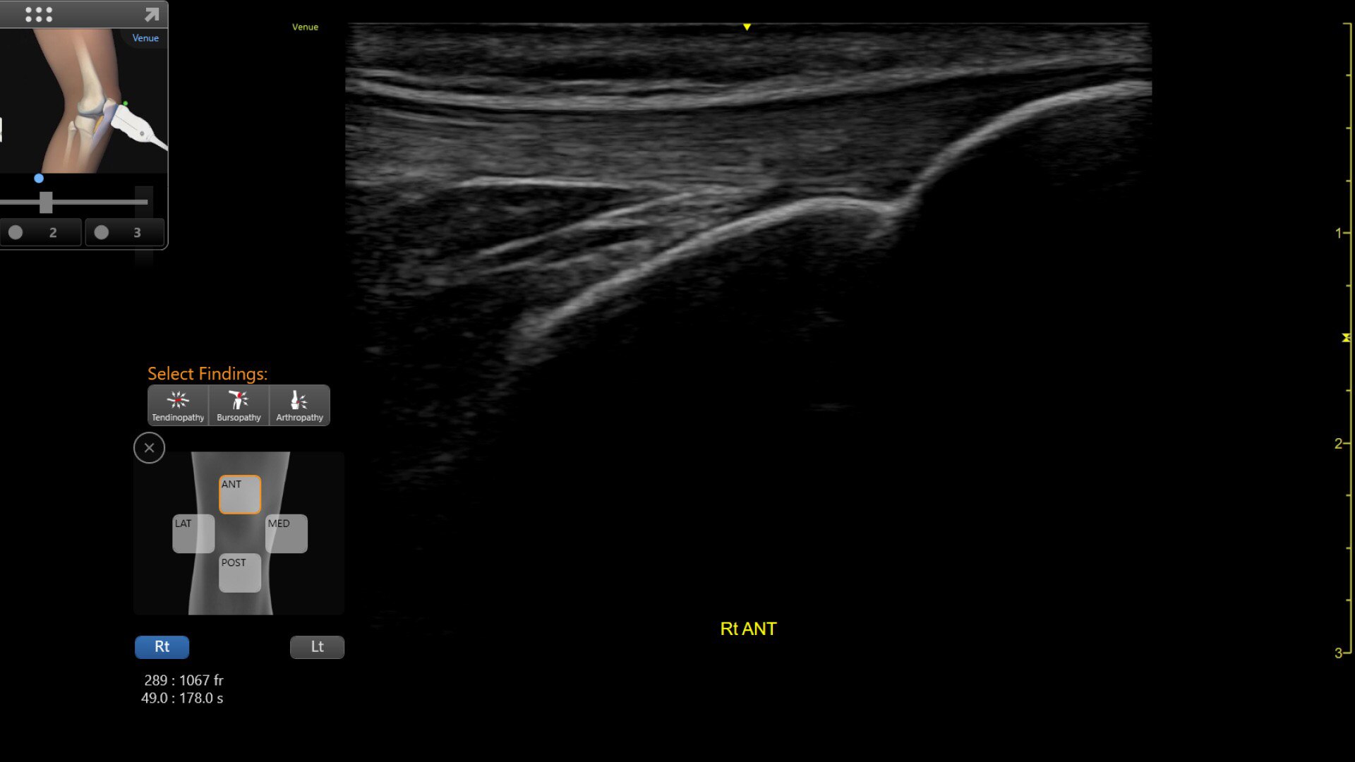 Product Media Carousel Image