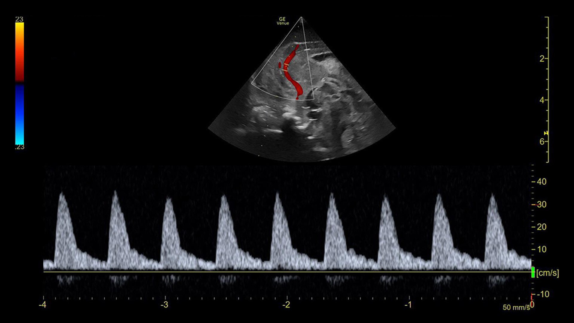 Product Media Carousel Image