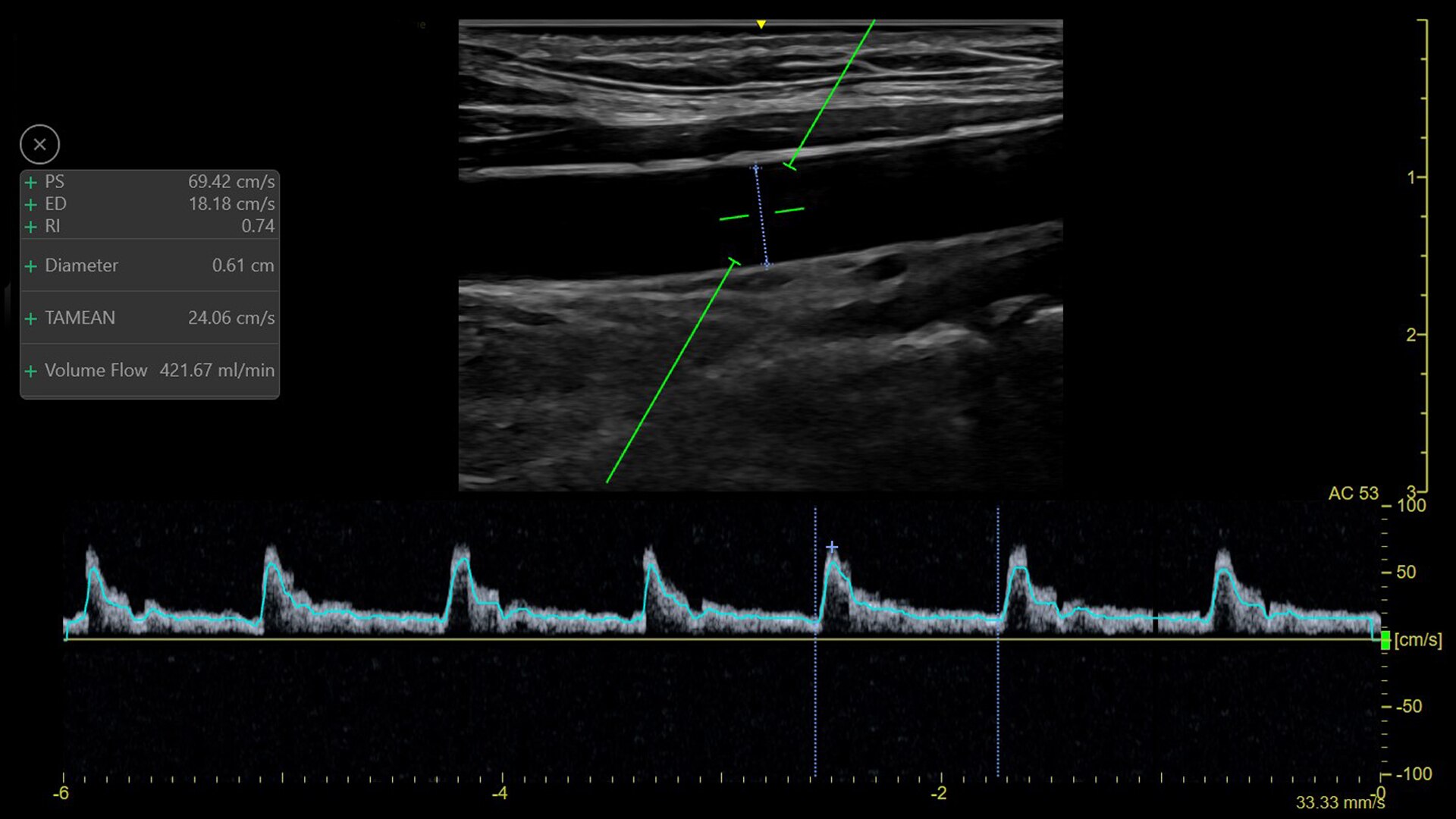 Product Media Carousel Image