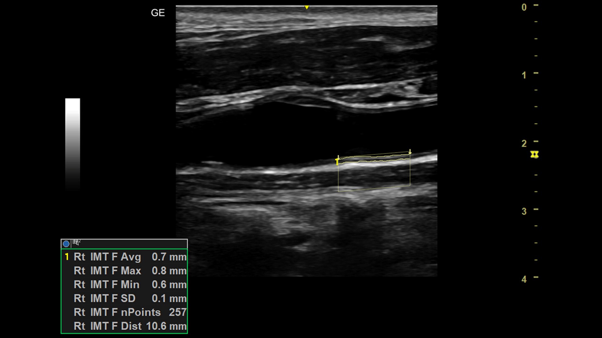 Product Media Carousel Image