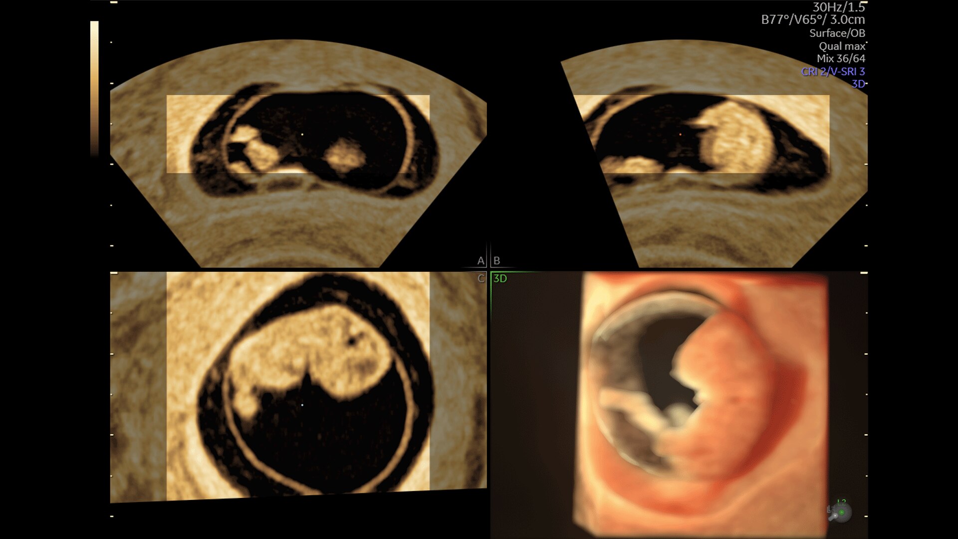 Product Media Carousel Image