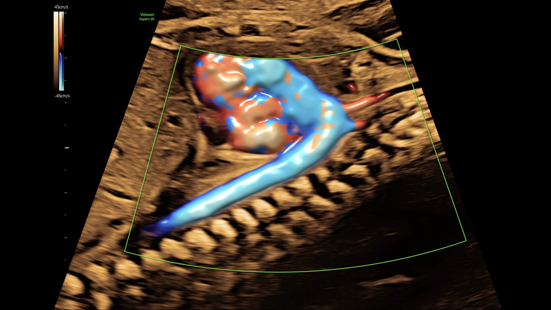 Product Media Carousel Image