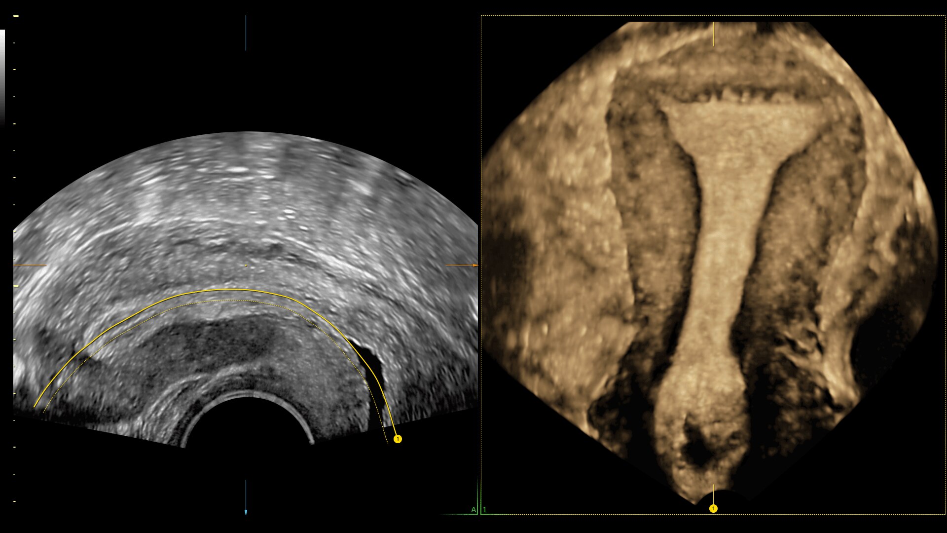 Product Media Carousel Image