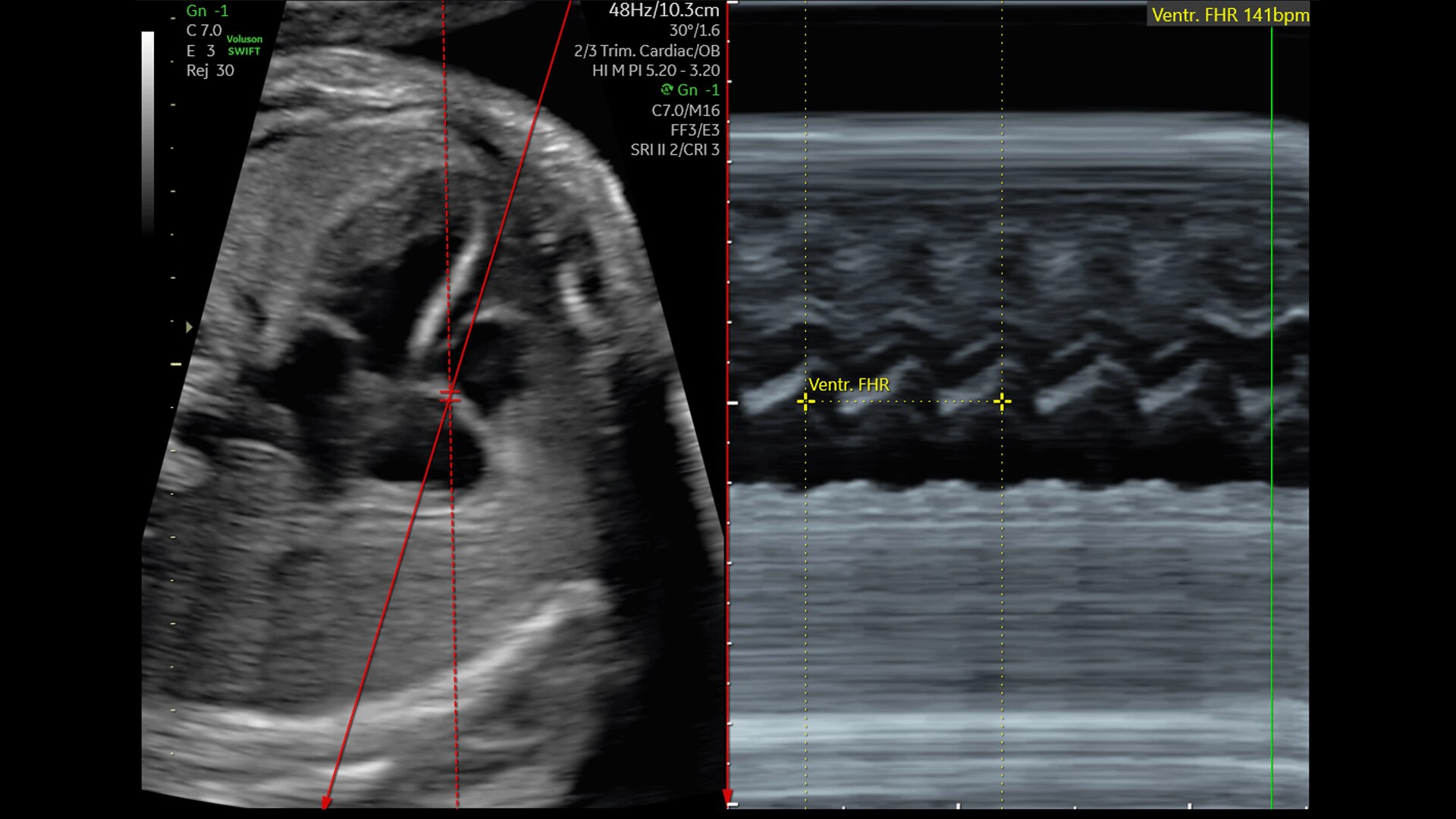 Product Media Carousel Image