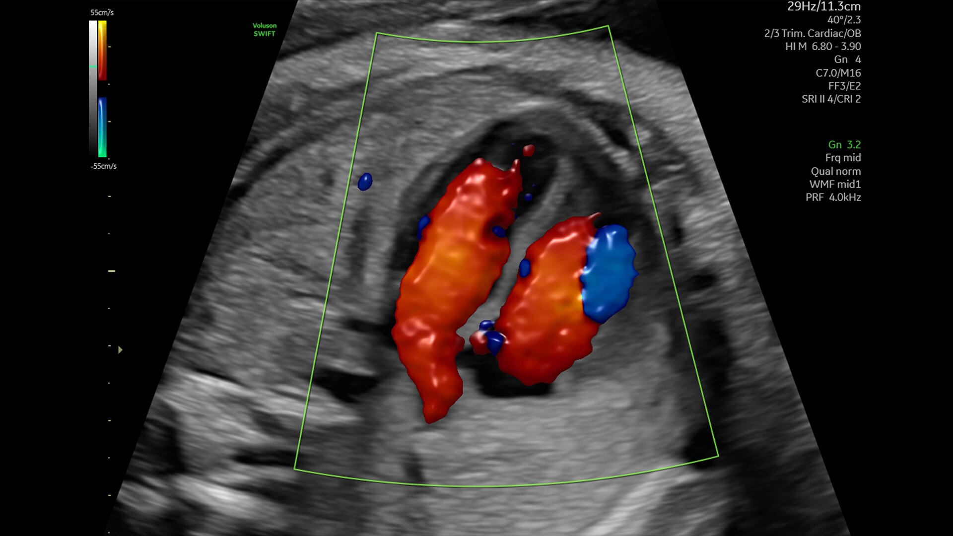 Product Media Carousel Image