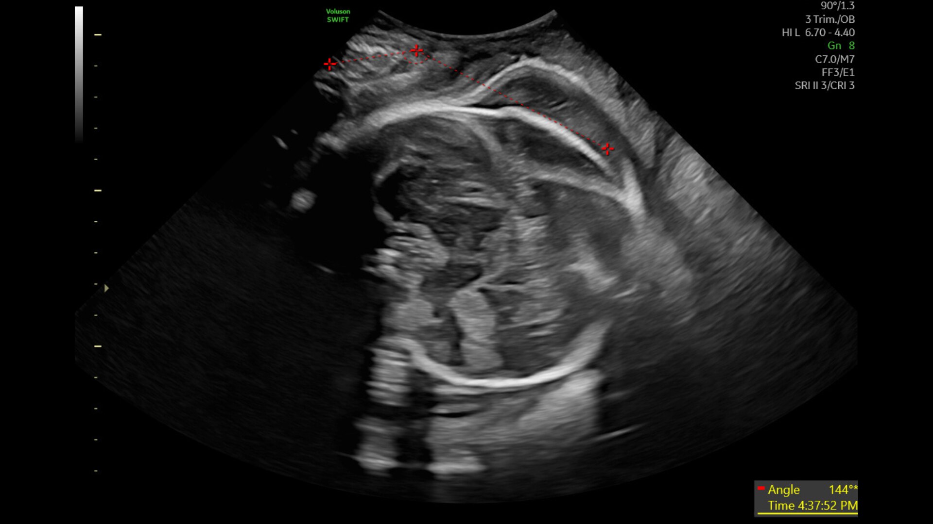 Product Media Carousel Image