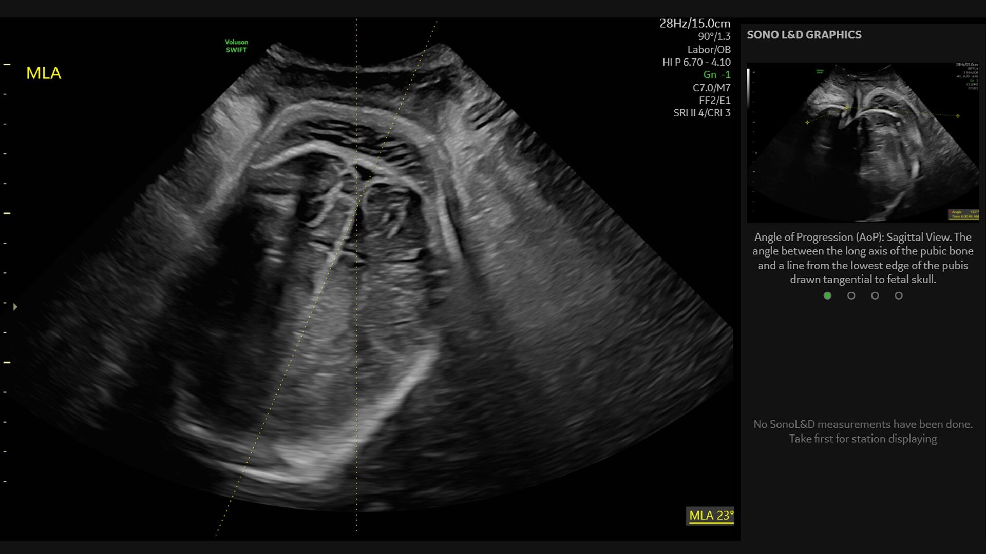 Product Media Carousel Image