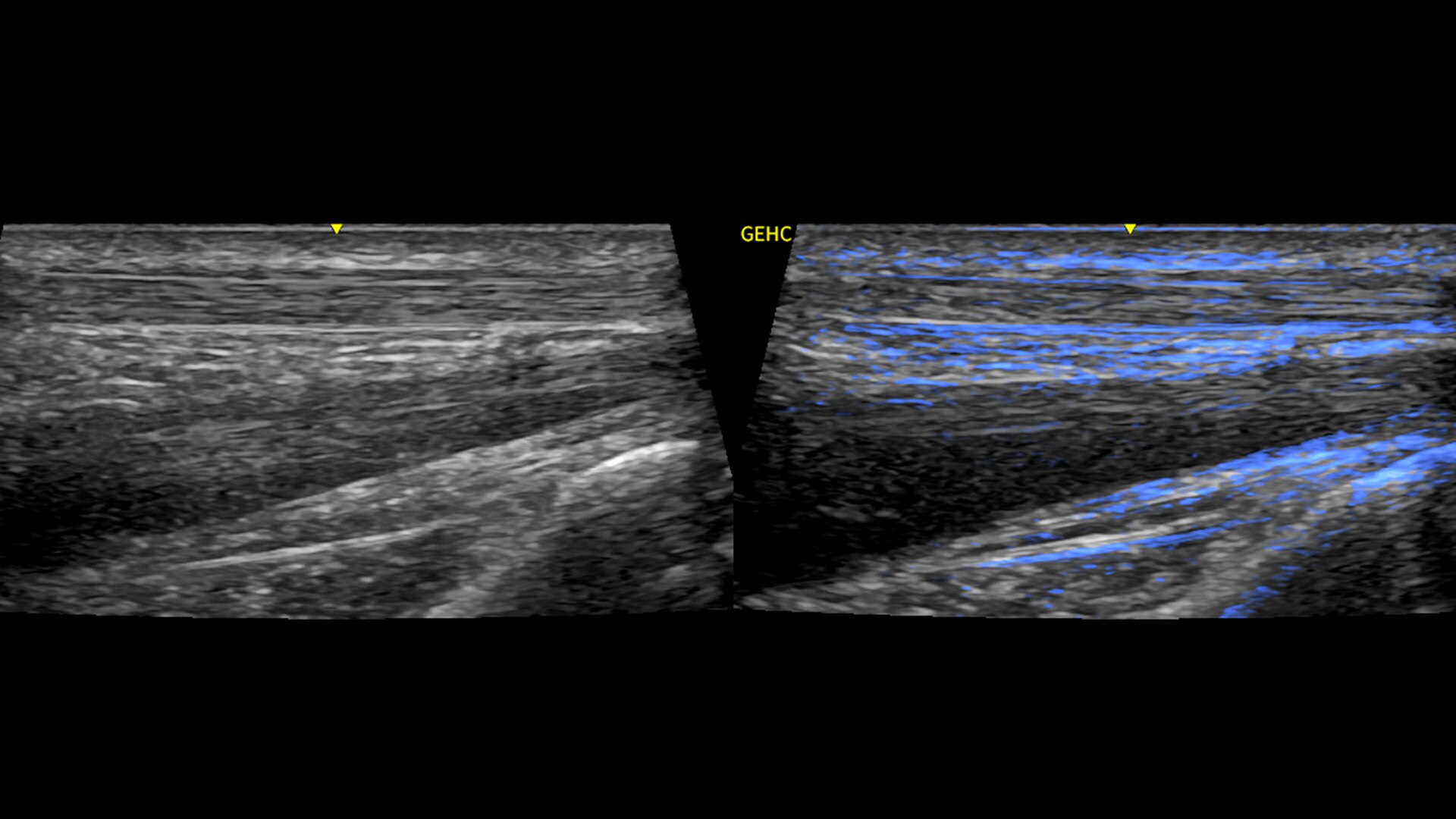 Product Media Carousel Image