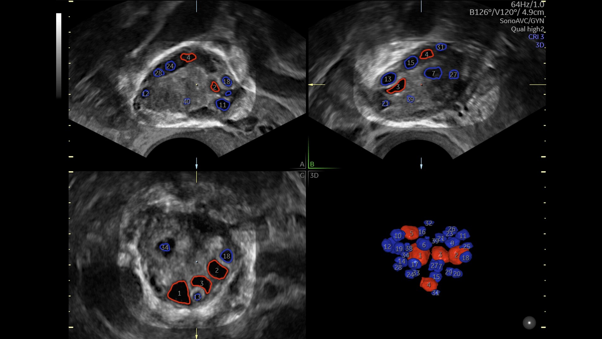 Product Media Carousel Image