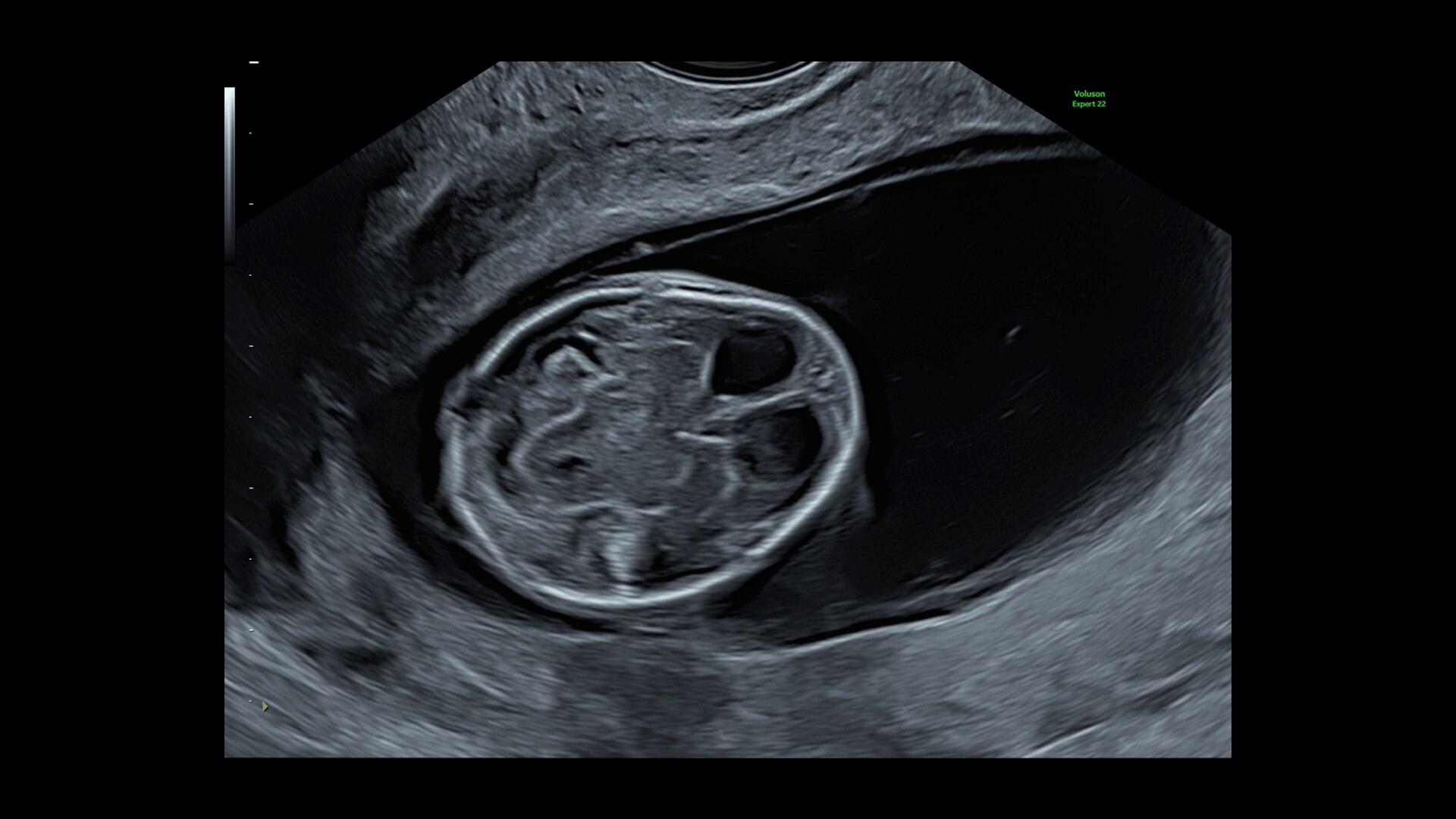 Product Media Carousel Image