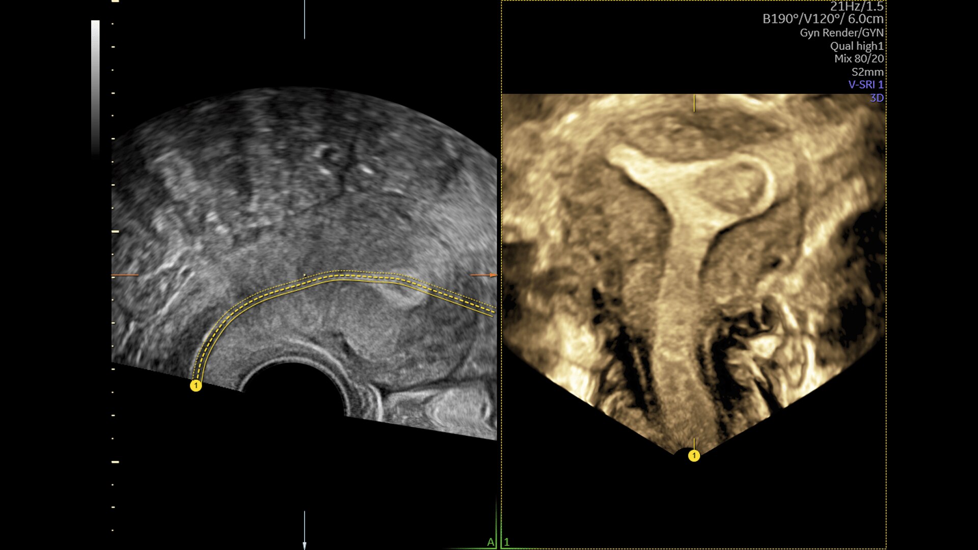 Product Media Carousel Image