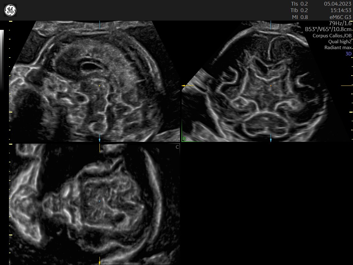 Product Media Carousel Image