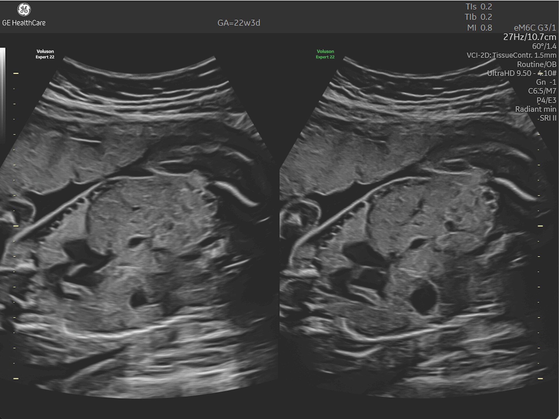 Product Media Carousel Image