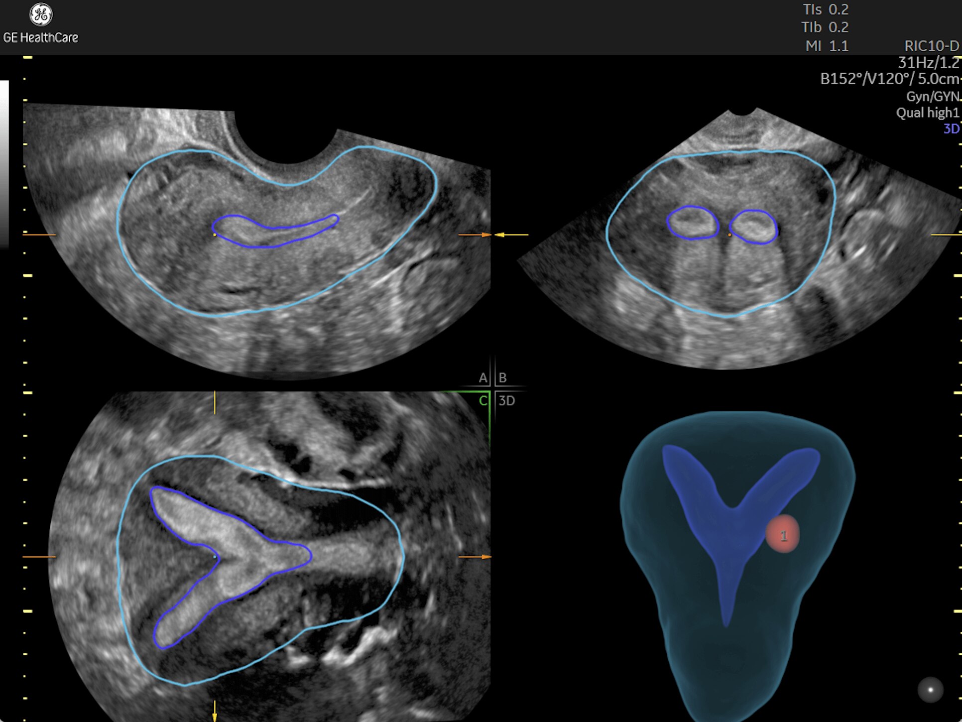 Product Media Carousel Image