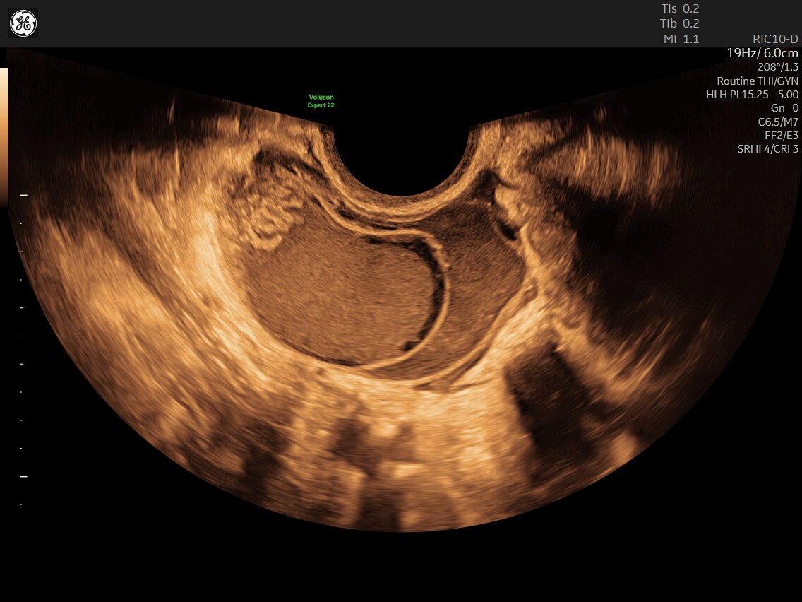 Product Media Carousel Image