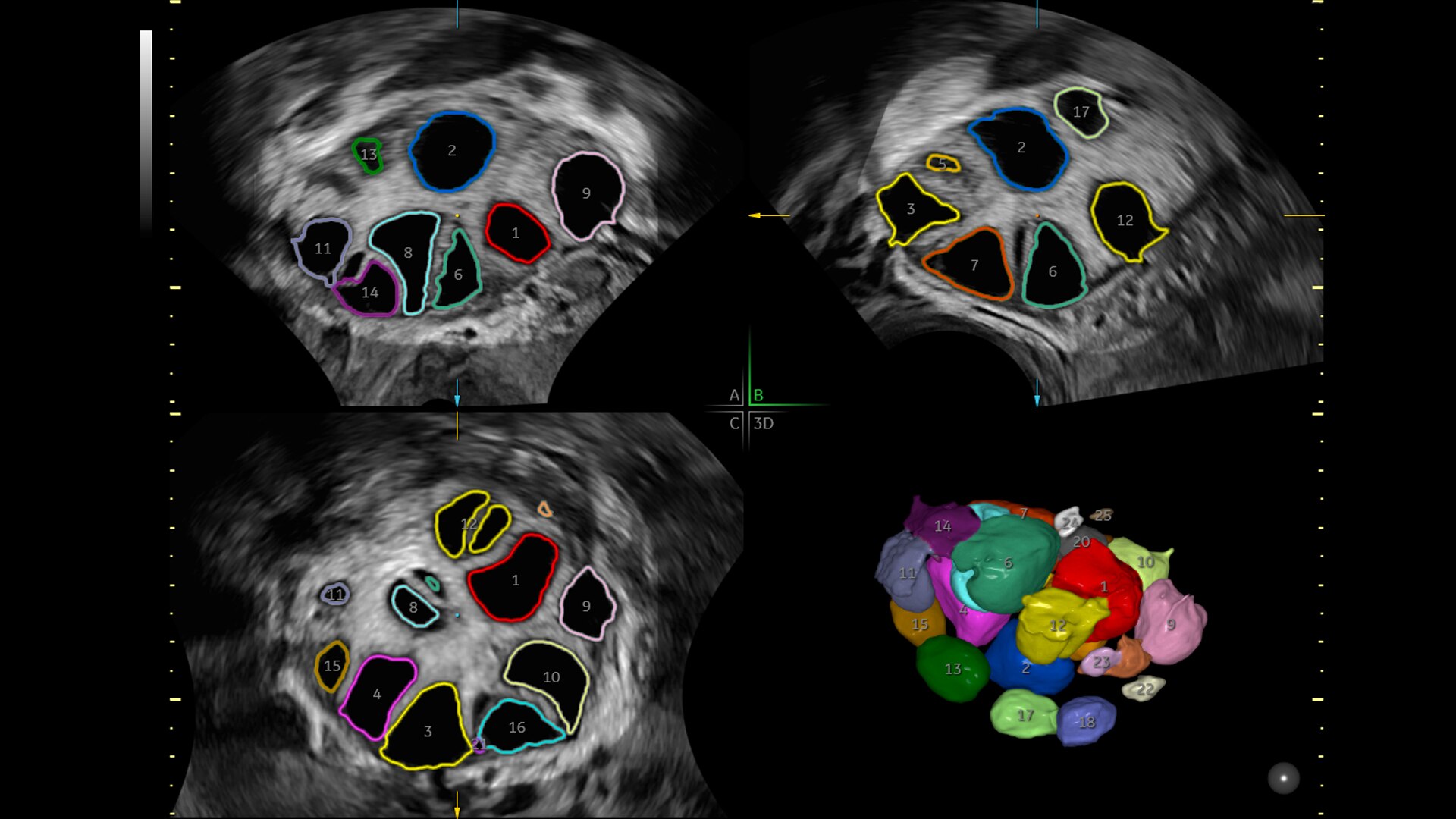 Product Media Carousel Image