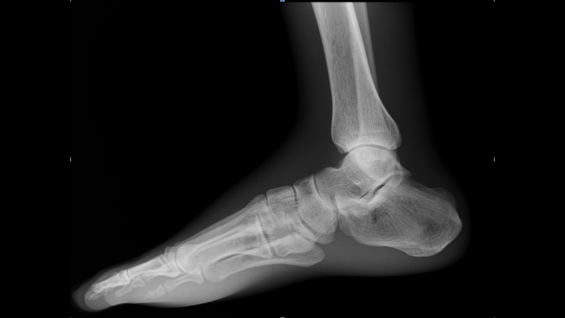 Product Media Carousel Image