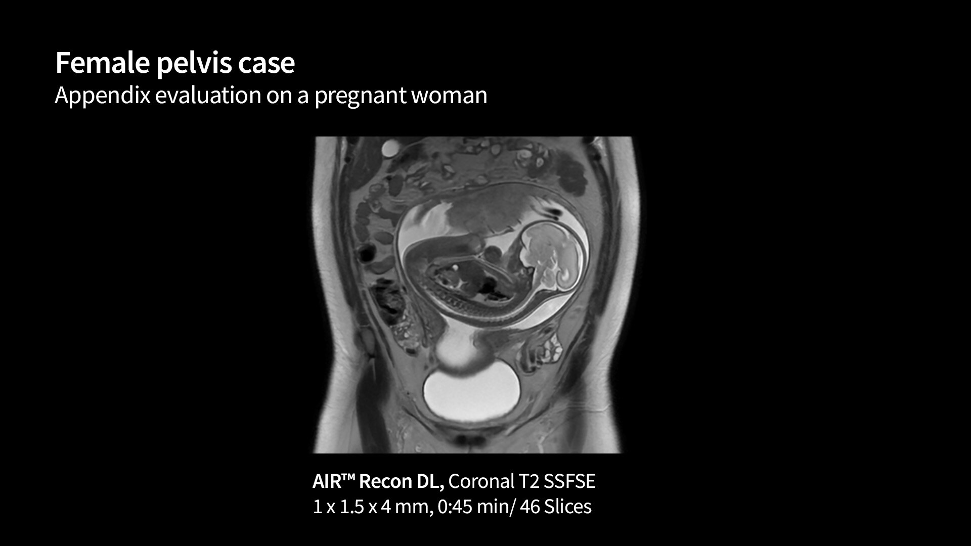 Product Media Carousel Image