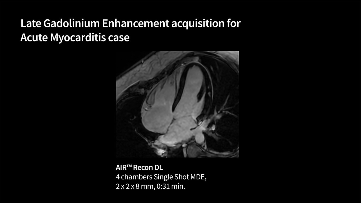 Product Media Carousel Image