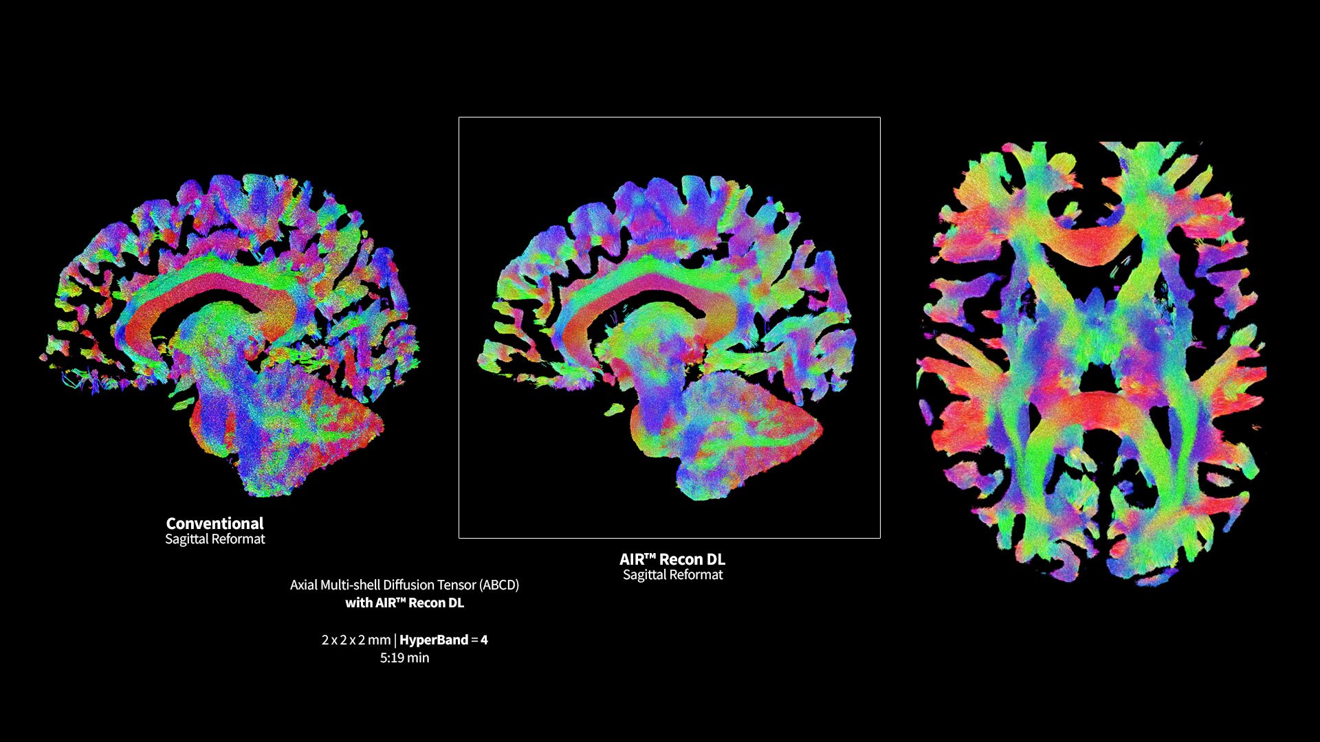Product Media Carousel Image