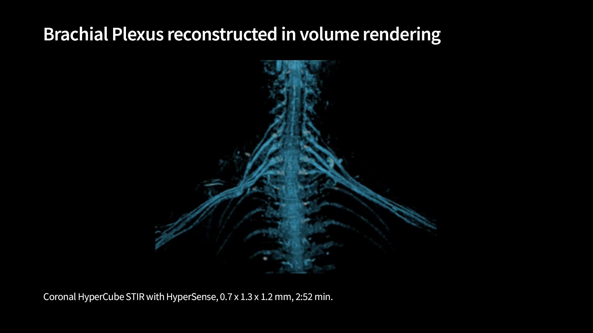 Product Media Carousel Image