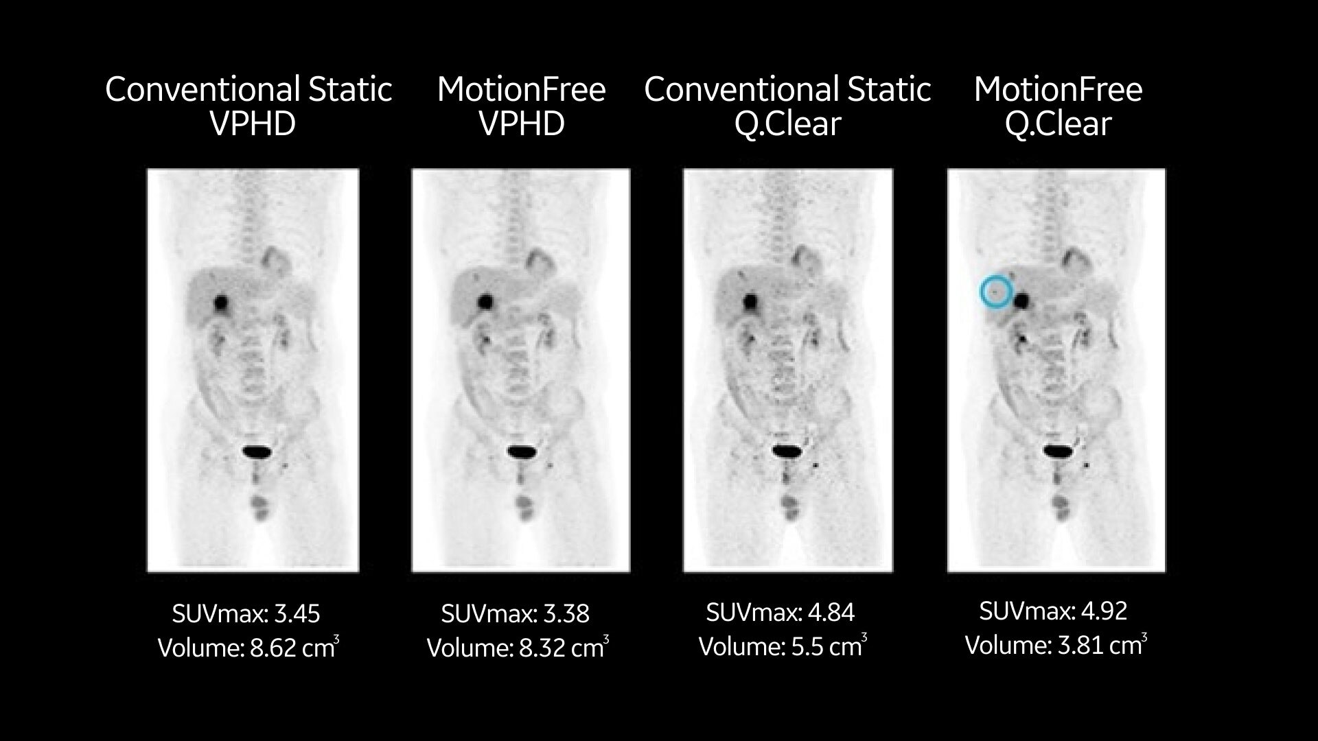 Product Media Carousel Image